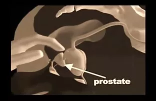 XXX हम एक दोस्त एथलीट से मिलने आए और उसे अपने विलाप के साथ सोने नहीं दिया
